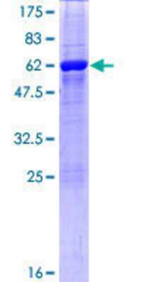 12.5% SDS-PAGE Stained with Coomassie Blue.