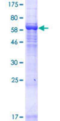 12.5% SDS-PAGE Stained with Coomassie Blue.