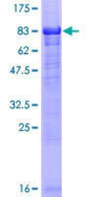 Other Recombinant Human NEK10 GST (N-Term) Protein