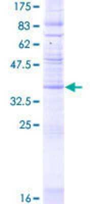 SDS-PAGE Recombinant Human Cklfsf8 GST (N-Term) Protein