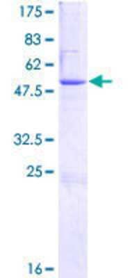 12.5% SDS-PAGE Stained with Coomassie Blue.