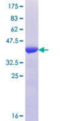12.5% SDS-PAGE Stained with Coomassie Blue.