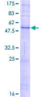 12.5% SDS-PAGE Stained with Coomassie Blue.