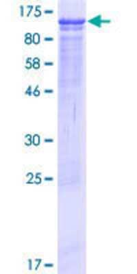 12.5% SDS-PAGE Stained with Coomassie Blue.