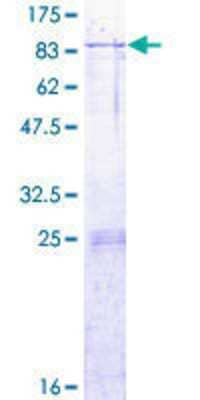 12.5% SDS-PAGE Stained with Coomassie Blue.