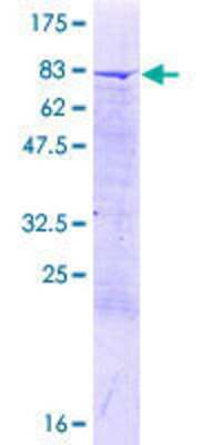 12.5% SDS-PAGE Stained with Coomassie Blue.