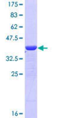 12.5% SDS-PAGE Stained with Coomassie Blue.