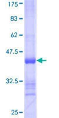 12.5% SDS-PAGE Stained with Coomassie Blue.