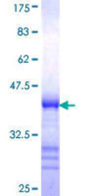 12.5% SDS-PAGE Stained with Coomassie Blue.