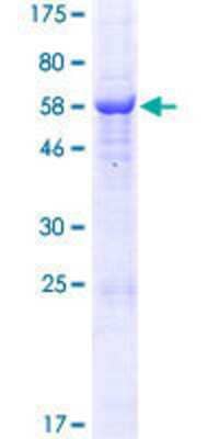 12.5% SDS-PAGE Stained with Coomassie Blue.