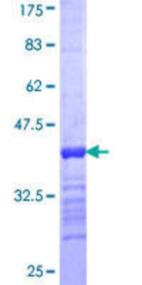 12.5% SDS-PAGE Stained with Coomassie Blue.
