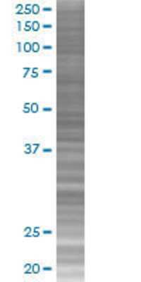 ZNF483 transfected lysate.