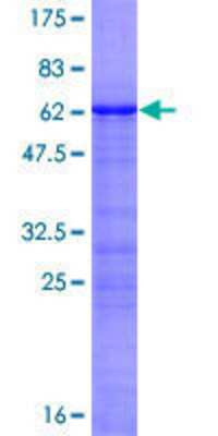 12.5% SDS-PAGE Stained with Coomassie Blue.