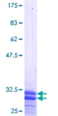 12.5% SDS-PAGE Stained with Coomassie Blue.