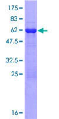 Other Recombinant Human TBC1D21 GST (N-Term) Protein