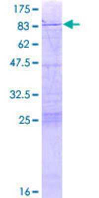 12.5% SDS-PAGE Stained with Coomassie Blue.