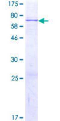 12.5% SDS-PAGE Stained with Coomassie Blue.