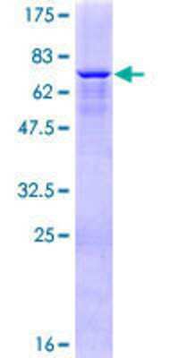 12.5% SDS-PAGE Stained with Coomassie Blue.