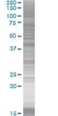 ZNF550 transfected lysate.