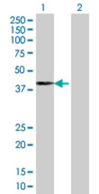 Lane 1: ZNF550 transfected lysate (45.54 KDa) Lane 2: Non-transfected lysate.