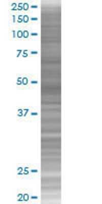 ZNF383 transfected lysate.