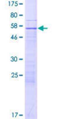 SDS-Page: Recombinant Human ZNF781 Protein [H00163115-P01] - 12.5% SDS-PAGE Stained with Coomassie Blue.