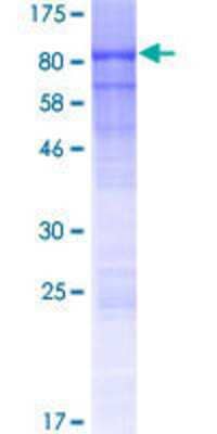 12.5% SDS-PAGE Stained with Coomassie Blue.