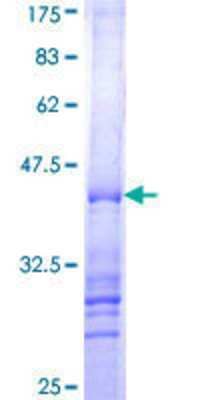 12.5% SDS-PAGE Stained with Coomassie Blue.