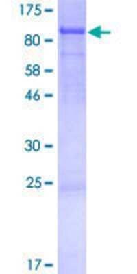 12.5% SDS-PAGE Stained with Coomassie Blue.