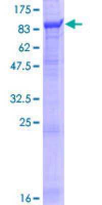 12.5% SDS-PAGE Stained with Coomassie Blue.