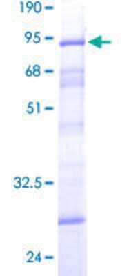 Other Recombinant Human DCP2 GST (N-Term) Protein