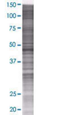 DCP2 transfected lysate.