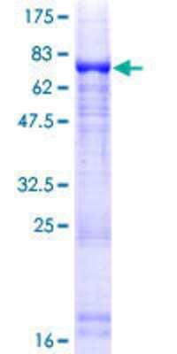 12.5% SDS-PAGE Stained with Coomassie Blue.