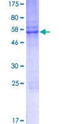 12.5% SDS-PAGE Stained with Coomassie Blue.