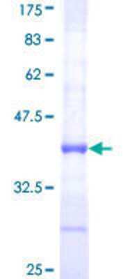 12.5% SDS-PAGE Stained with Coomassie Blue.