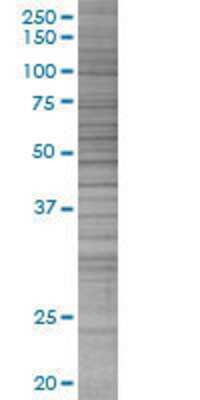 ZNF92 transfected lysate.
