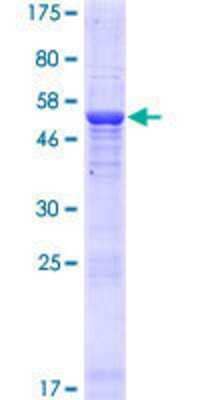 Other Recombinant Human THAP5 GST (N-Term) Protein