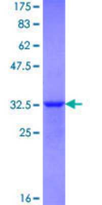 12.5% SDS-PAGE Stained with Coomassie Blue.