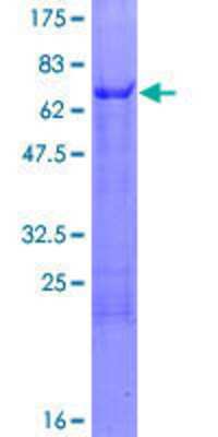 12.5% SDS-PAGE Stained with Coomassie Blue.