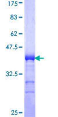 12.5% SDS-PAGE Stained with Coomassie Blue.