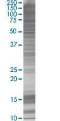 ADAMTS18 transfected lysate.