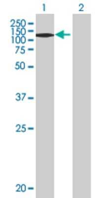Lane 1: ADAMTS18 transfected lysate (135.1 KDa) Lane 2: Non-transfected lysate.