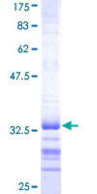 12.5% SDS-PAGE Stained with Coomassie Blue.