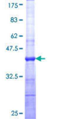 12.5% SDS-PAGE Stained with Coomassie Blue.