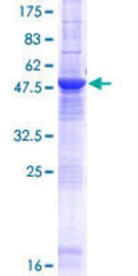 Other Recombinant Human METTL21C GST (N-Term) Protein