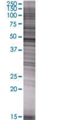 LDHD transfected lysate.