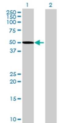 Lane 1: LDHD transfected lysate (55.88 KDa) Lane 2: Non-transfected lysate.