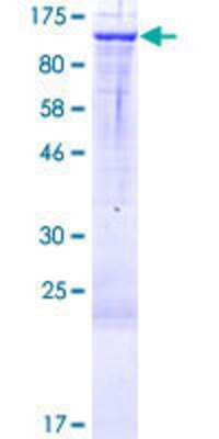 12.5% SDS-PAGE Stained with Coomassie Blue.