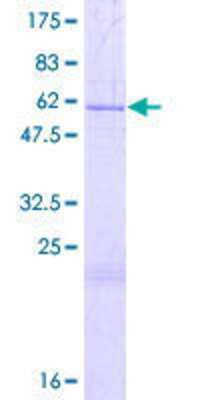 Other Recombinant Human THAP8 GST (N-Term) Protein