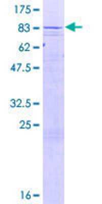 12.5% SDS-PAGE Stained with Coomassie Blue.